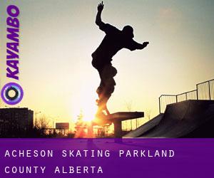 Acheson skating (Parkland County, Alberta)